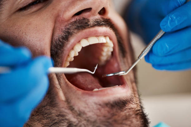 Best Cosmetic Emergency Dentistry in Fort Clark Springs, TX